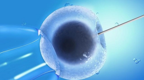 美国试管单精子注射受精率高的两大重要保障