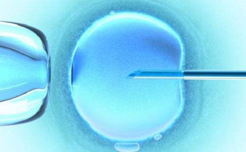去美国做试管婴儿：移植前为什么要做B超检查？