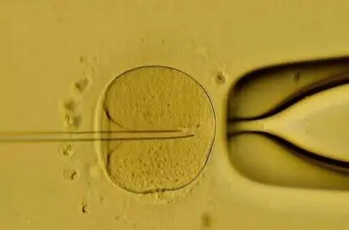 去美国做试管婴儿，移植两个囊胚就可以怀双胞胎吗？